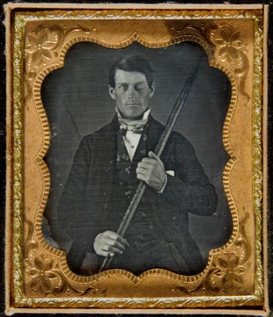 phineasgage